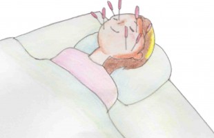 美容鍼　エステ