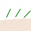 鍼　刺さってる　イラスト