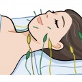 美容鍼　イラスト　電気
